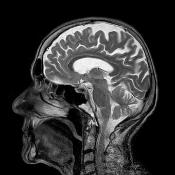 Brain x-ray